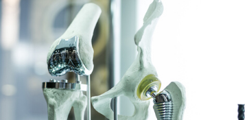 Joint replacement